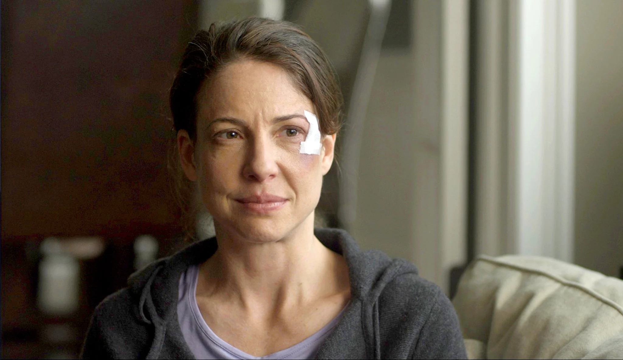 Concussion